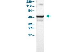 Western Blot analysis of human cell line RT-4. (UCKL1 antibody  (AA 86-203))