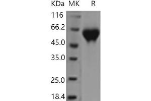 Western Blotting (WB) image for Interleukin 1 Receptor, Type II (IL1R2) (Active) protein (His tag) (ABIN7196348) (IL1R2 Protein (His tag))
