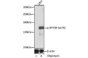 Western blot analysis of extracts of 293T cells using Phospho-RPTOR(Ser792) Polyclonal Antibody at dilution of 1:1000. (Raptor antibody  (pSer792))