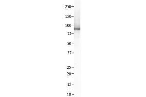 Host:  Rabbit  Target Name:  ITGB8  Sample Type:  Human Kidney  Antibody Dilution:  1. (ITGB8 antibody  (C-Term))