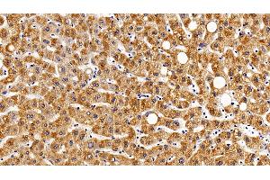 Detection of gp130 in Human Liver Tissue using Polyclonal Antibody to Glycoprotein 130 (gp130) (CD130/gp130 antibody  (AA 392-566))