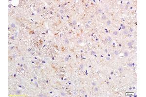 Formalin-fixed and paraffin embedded rat brain tissue labeled with Anti-APOE4/Apolipoprotein E4 Polyclonal Antibody, Unconjugated (ABIN708746) at 1:200 followed by conjugation to the secondary antibody (APOE antibody  (AA 101-200))