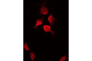 ABIN6267501 staining HeLa by IF/ICC. (p21 antibody  (pThr145))