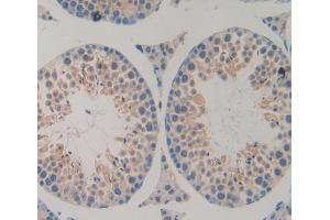 IHC-P analysis of Kidney tissue, with DAB staining. (ATG7 antibody  (AA 23-238))