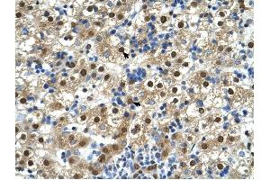 GDE1 antibody was used for immunohistochemistry at a concentration of 4-8 ug/ml to stain Hepatocytes (arrows) in Human Liver.