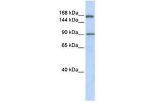 Image no. 1 for anti-AF4/FMR2 Family, Member 2 (AFF2) (AA 1224-1273) antibody (ABIN6740531) (AFF2 antibody  (AA 1224-1273))