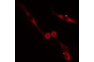 ABIN6272622 staining HepG2 cells by IF/ICC. (NRBP1 antibody  (Internal Region))