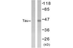 Western blot analysis of extracts from 293 cells, treated with UV, using Tau (Ab-404) Antibody. (tau antibody  (AA 691-740))