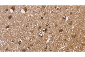 Immunohistochemistry of paraffin-embedded Human brain tissue using EXTL3 Polyclonal Antibody at dilution 1:30 (EXTL3 antibody)