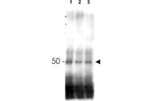 Western blot using MER2 polyclonal antibody  shows detection of phosphorylated and unphosphorylated MER2 in wild type, phosphatase treated and mutant cells. (CD151 antibody  (AA 26-35))