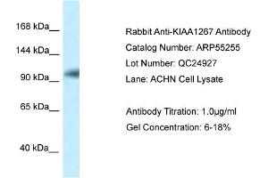 Western Blotting (WB) image for anti-KAT8 Regulatory NSL Complex Subunit 1 (KANSL1) (N-Term) antibody (ABIN970994) (KANSL1 antibody  (N-Term))
