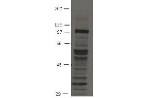 Image no. 1 for anti-Fibroblast Growth Factor Receptor 4 (FGFR4) (Cytoplasmic Domain) antibody (ABIN1169685) (FGFR4 antibody  (Cytoplasmic Domain))