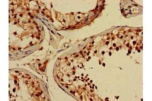 Immunohistochemistry of paraffin-embedded human testis tissue using ABIN7148821 at dilution of 1:100 (CREB3L4 antibody  (AA 13-133))
