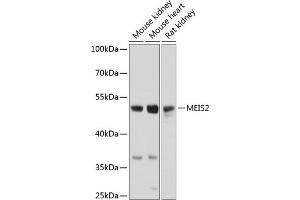 Western blot analysis of extracts of various cell lines, using MEIS2 antibody (ABIN6128272, ABIN6143723, ABIN6143724 and ABIN6224498) at 1:1000 dilution. (MEIS2 antibody  (AA 351-470))
