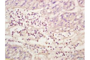 Formalin-fixed and paraffin embedded human liver labeled with Anti-phospho-ERK1/2(Thr202 + Tyr204) Polyclonal Antibody, Unconjugated (ABIN682933) at 1:200 followed by conjugation to the secondary antibody and DAB staining (ERK1/2 antibody  (pThr202, pTyr204))