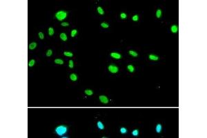 Immunofluorescence analysis of A549 cells using RUVBL1 Polyclonal Antibody (RUVBL1 antibody)