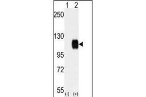 Western blot analysis of SKY (arrow) using rabbit polyclonal SKY Antibody (C-term) (ABIN392054 and ABIN2841821). (TYRO3 antibody  (C-Term))