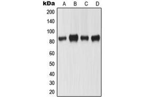 Western blot analysis of MLH1 expression in KNRK (A), HeLa (B), A431 (C), SW480 (D) whole cell lysates.