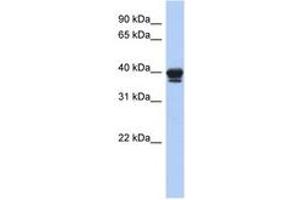 Image no. 1 for anti-N-Acyl Phosphatidylethanolamine phospholipase D (NAPEPLD) (AA 71-120) antibody (ABIN6743927)