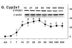 Age-related expression of CYP-2 family gene/proteins in livers of male rats. (CYP2E1 antibody  (AA 401-493))