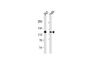 Lane 1: 293 Cell lysates, Lane 2: HeLa Cell lysates, probed with MSH2 (1184CT1. (MSH2 antibody)