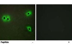 Immunofluorescence analysis of A-549 cells, using COL13A1 polyclonal antibody .