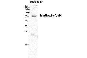 Western Blotting (WB) image for anti-FYN Oncogene Related To SRC, FGR, YES (FYN) (pTyr530) antibody (ABIN3182518) (FYN antibody  (pTyr530))