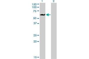 Western Blotting (WB) image for anti-Eukaryotic Translation Initiation Factor 4 gamma 3 (EIF4G3) (AA 1-515) antibody (ABIN563748)