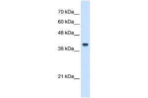 IFI44L antibody used at 5 ug/ml to detect target protein. (IFI44L antibody  (N-Term))