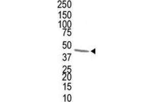 Western Blotting (WB) image for anti-Farnesyl Diphosphate Synthase (FDPS) antibody (ABIN3001523)