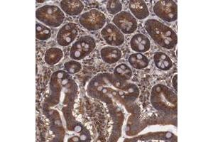 Immunohistochemical staining of human duodenum with TXNDC16 polyclonal antibody  shows strong cytoplasmic positivity in glandular cells.