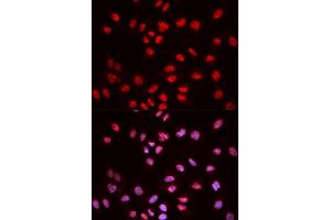 Immunofluorescence analysis of MCF-7 cells using Phospho-ELK1-S383 antibody (ABIN5969890).