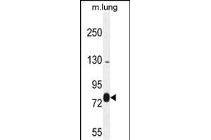 EXOC8 Antibody (Center) (ABIN654161 and ABIN2844025) western blot analysis in mouse lung tissue lysates (35 μg/lane). (EXOC8 antibody  (AA 360-389))