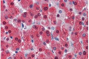 Human Liver (formalin-fixed, paraffin-embedded) stained with LASS2 antibody ABIN462181 followed by biotinylated goat anti-rabbit IgG secondary antibody ABIN481713, alkaline phosphatase-streptavidin and chromogen. (Ceramide Synthase 2 antibody  (AA 72-121))