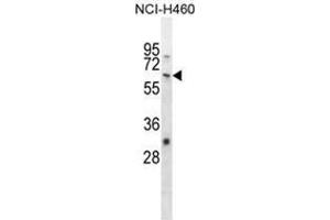 WHSC2 Antibody (Center) western blot analysis in NCI-H460 cell line lysates (35 µg/lane). (WHSC2 antibody  (Middle Region))
