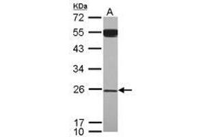 Image no. 1 for anti-YEATS Domain Containing 4 (AA 1-203) antibody (ABIN1501789) (GAS41 antibody  (AA 1-203))