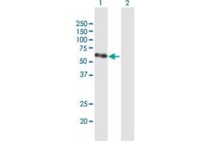 Western Blot analysis of VEGFC expression in transfected 293T cell line by VEGFC MaxPab polyclonal antibody. (VEGFC antibody  (AA 1-419))
