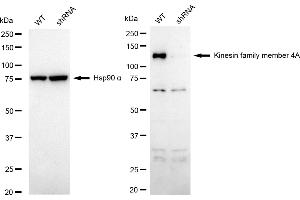 Western blotting analysis using kinesin family member 4A antibody (ABIN7799207). (Recombinant KIF4A antibody)