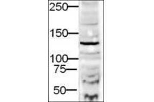 Image no. 1 for anti-Diaphanous Homolog 2 (DIAPH2) (AA 1085-1101) antibody (ABIN199948) (DIAPH2 antibody  (AA 1085-1101))