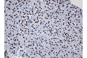 Image no. 6 for anti-Decapping Enzyme, Scavenger (DCPS) antibody (ABIN1497780) (DCPS antibody)
