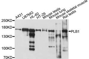 Western blot analysis of extracts of various cell lines, using PLB1 antibody (ABIN4904785) at 1:1000 dilution. (Phospholipase B antibody)