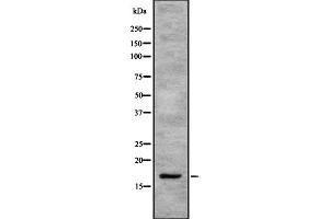 Western blot analysis SEP15 using K562 whole cell lysates. (Selenoprotein F antibody)