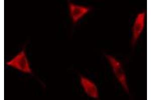 ABIN6267620 staining HeLa cells by IF/ICC. (Caldesmon antibody  (pSer789))