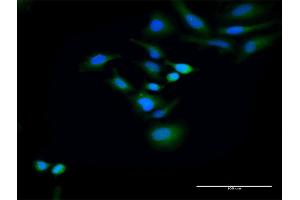 Immunofluorescence of purified MaxPab antibody to HOMER2 on HeLa cell. (HOMER2 antibody  (AA 1-343))
