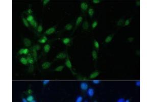 Immunofluorescence analysis of NIH-3T3 cells using MAD2L1 Polyclonal Antibody at dilution of 1:100 (40x lens). (MAD2L1 antibody)