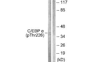 Western blot analysis of extracts from COS7 cells, treated with EGF (200ng/ml, 30mins), using C/EBP-α (Phospho-Thr226) antibody. (CEBPA antibody  (pThr226))