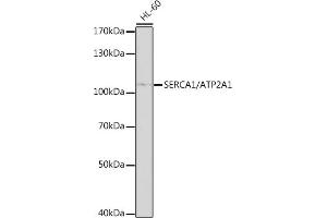 Western blot analysis of extracts of HL-60 cells, using SERC/SERC/ antibody (0104) at 1:1000 dilution. (ATP2A1/SERCA1 antibody  (AA 350-600))