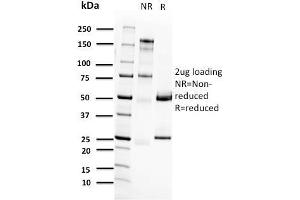 SDS-PAGE Analysis Purified RET Mouse Monoclonal Antibody (RET/2662). (Ret Proto-Oncogene antibody  (AA 702-848))