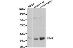 Western Blotting (WB) image for anti-Growth Arrest-Specific 2 (GAS2) antibody (ABIN1872778) (GAS2 antibody)