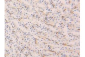 Detection of FABP4 in Mouse Kidney Tissue using Polyclonal Antibody to Fatty Acid Binding Protein 4 (FABP4) (FABP4 antibody  (AA 2-132))